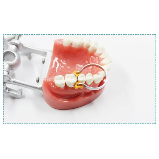 Matrix Band Kits Cotisen Brand Package